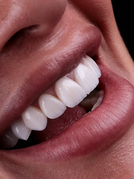 Sorriso tratado pela Dra. Cynthia Ferreira