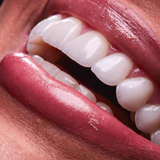 Close-up de um sorriso