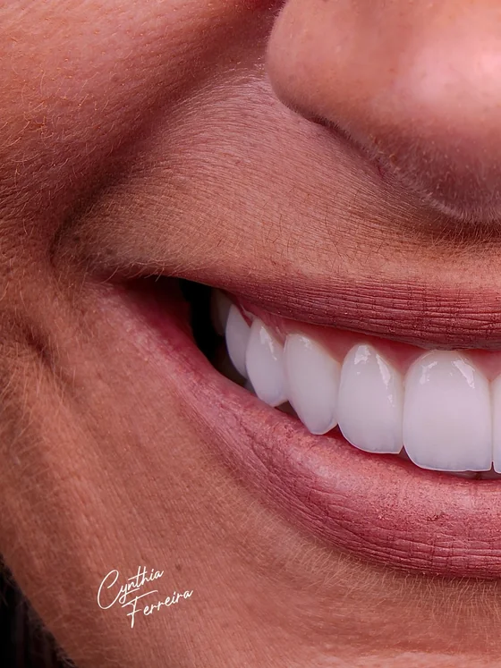 Close-up de um sorriso